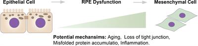 Role of Epithelial-Mesenchymal Transition in Retinal Pigment Epithelium Dysfunction